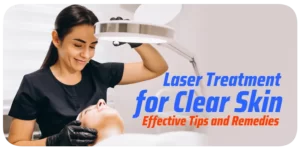 Laser Treatment for Clear Skin Removing Acne and Blackheads
